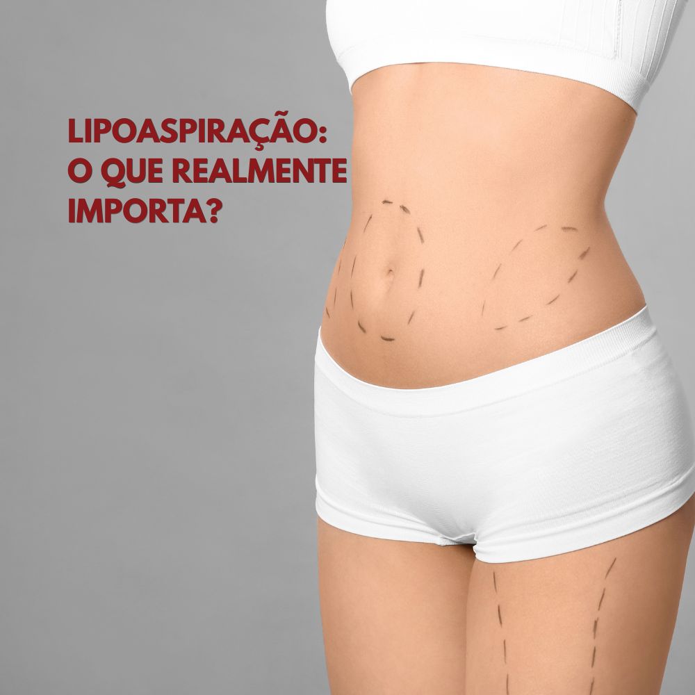 PREÇO DA LIPOASPIRAÇÃO