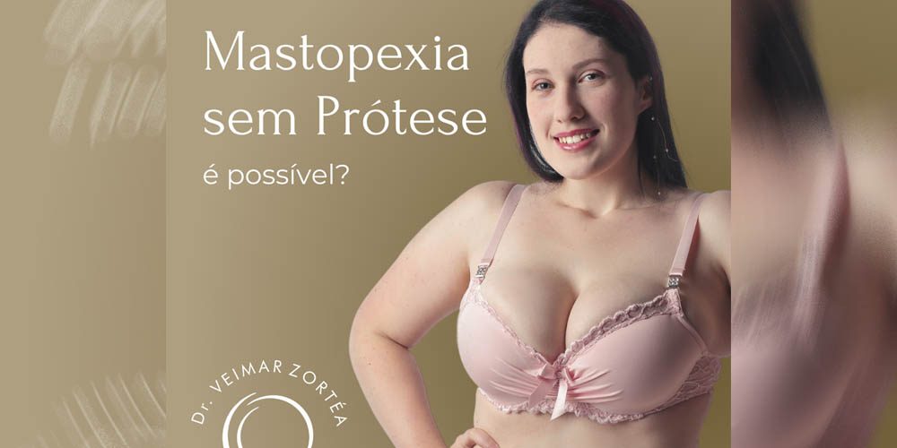 Mastopexia sem prótese | É possível?