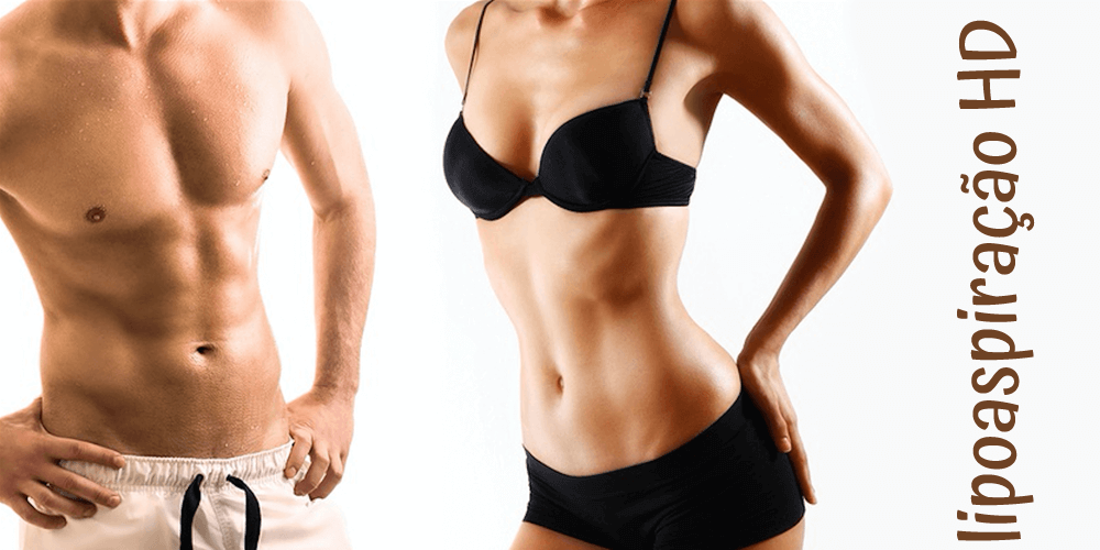 O que é lipoaspiração HD e para quem é indicada