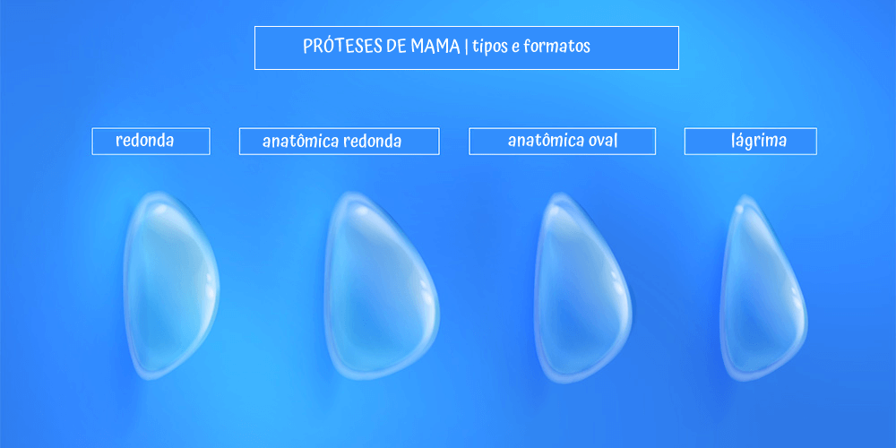 Prótese de mama: tipos, formatos e mitos