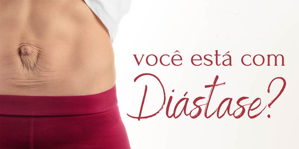 Você está com diástase? Vem fazer sua cirurgia plástica!