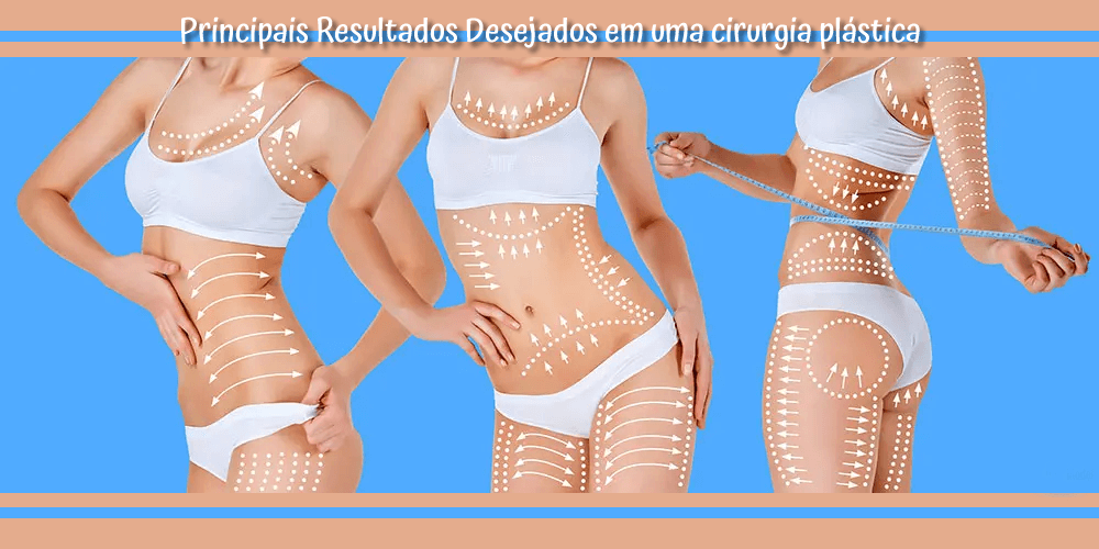 Principais Resultados Desejados em uma cirurgia plástica