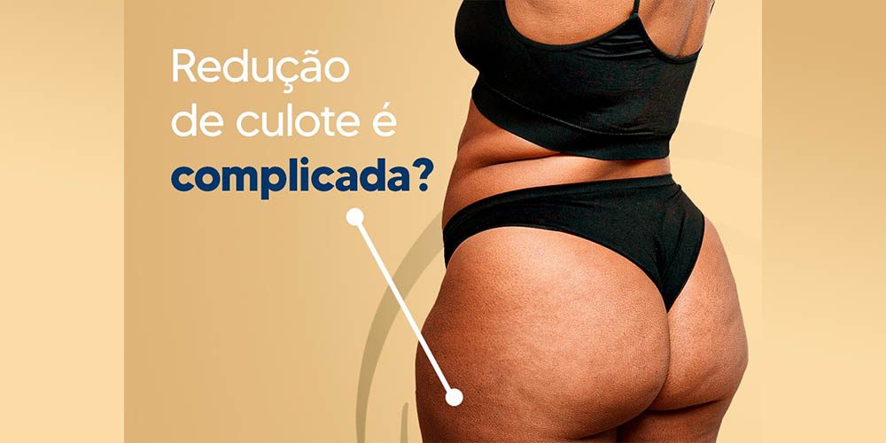 Redução de culote é complicada?